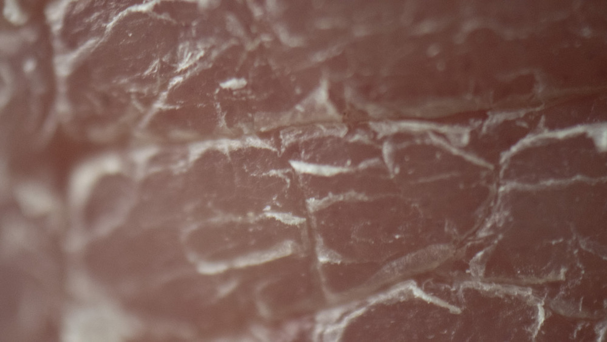 A close up image of dry skin.