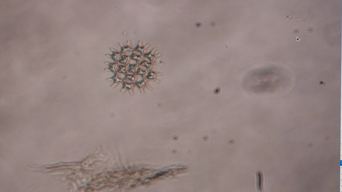 A microscopic image of phytoplankton and algae.