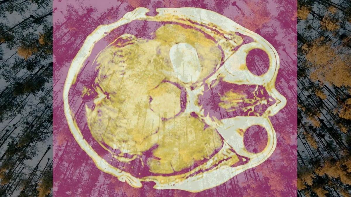 A still from Robyn Woolston's film Swell, showing an image of a brain scan.